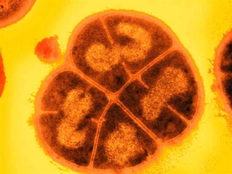 Bacteria que soporta la radiación extrema