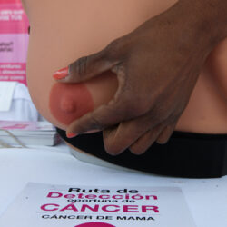 Expertos alertan sobre la falta de registros de cáncer de mama en América Latina