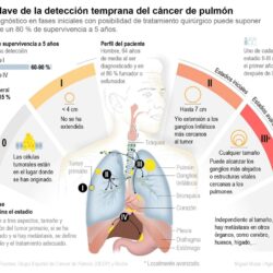 Supervivencia al cáncer de pulmón sube del 23 al 60 % con diagnóstico temprano, dice experta
