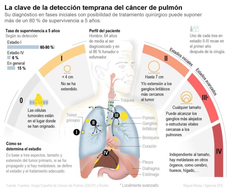 Supervivencia al cáncer de pulmón sube del 23 al 60 % con diagnóstico temprano, dice experta