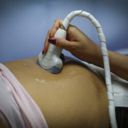 Bifidobacterium breve, may help support fetal growth!